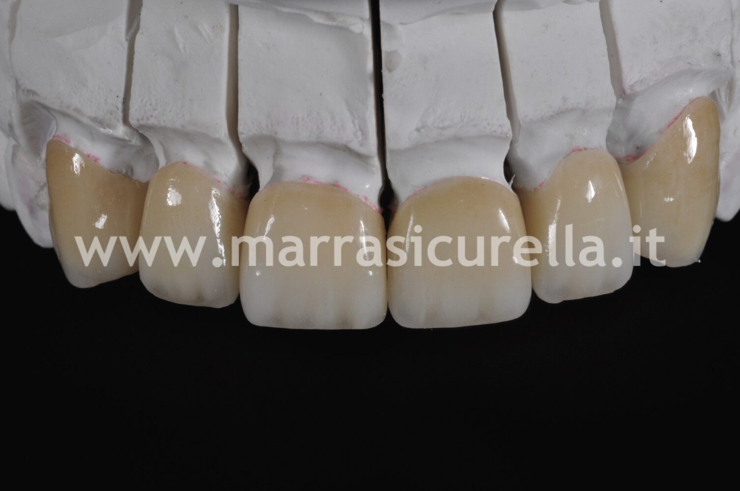 colla per denti naturali che si muovono